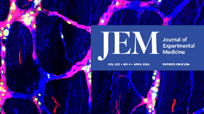Liver-X-receptor agonism enhances T cell priming and activation to promote anti-tumor immunity